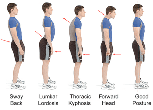 Featured image for: Which Causes Pain, a Muscle or a Bone?